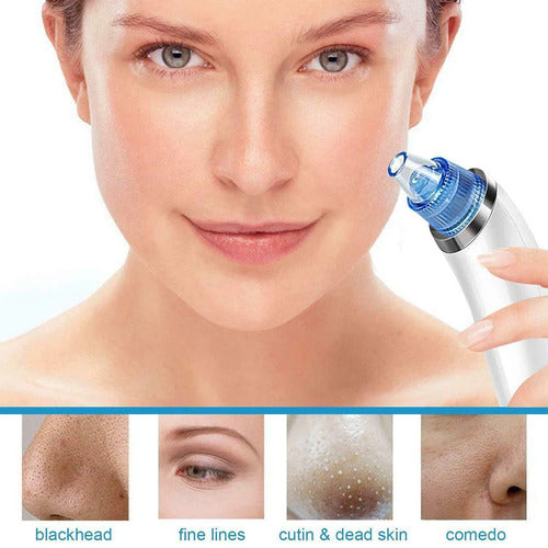 Derma Suction Facial Pore Cleanser Machine